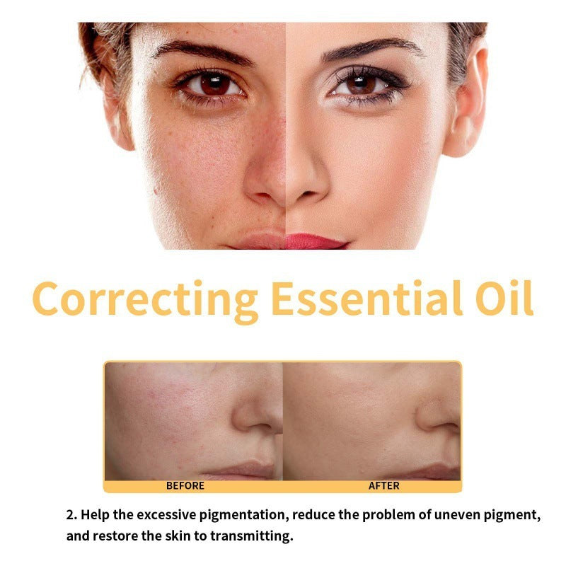 Moisturizing Treatment Oil Fade Facial Skin Fine Lines